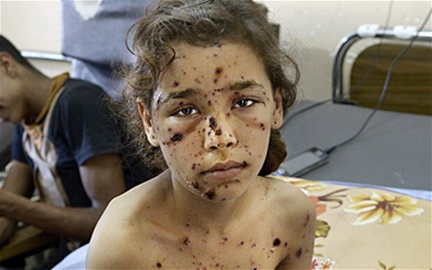 Gaza Luka yang Tak Sembuh: Ketika Anak-anak Kehilangan Masa Depannya