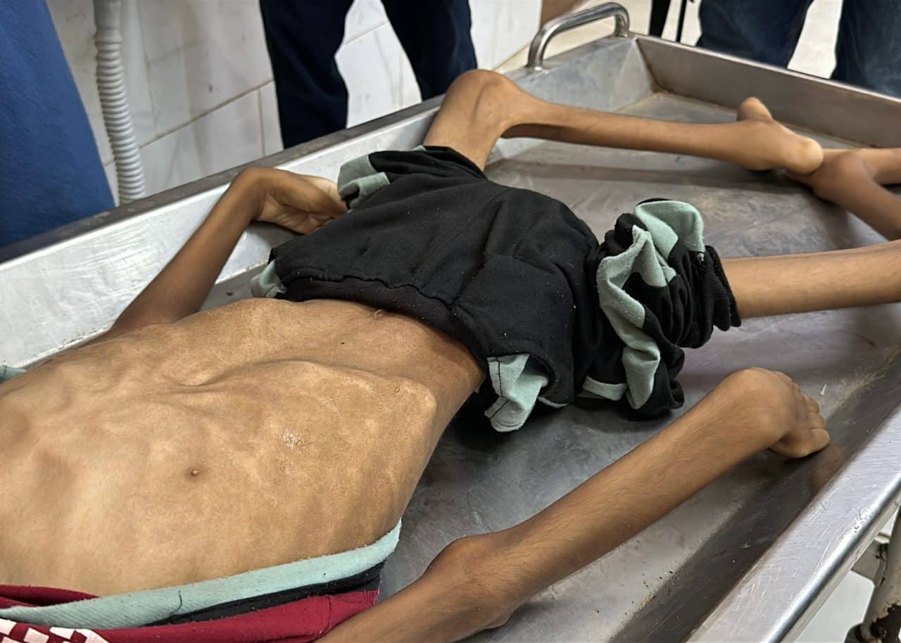 Lebih dari 40.000 Bayi di Gaza Terancam Meninggal Akibat Blokade Israel