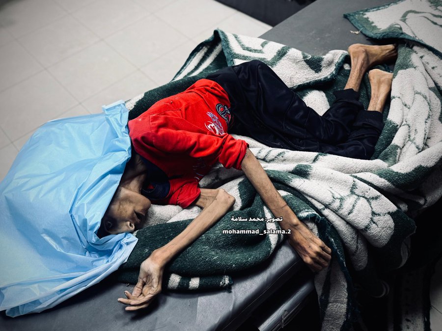 Tubuh Separuh Nyawa: Kisah Rahil dari Gaza yang Mati Perlahan Karena Kelaparan