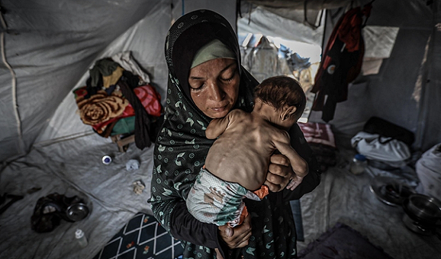 Kelaparan Renggut Nyawa 222 Korban Jiwa di Gaza, Setengahnya Anak-anak