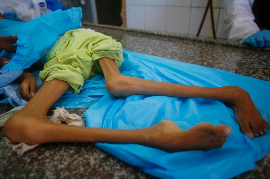 Laporan IPC: Gaza Masuki Fase Kelaparan Terburuk Abad Ini