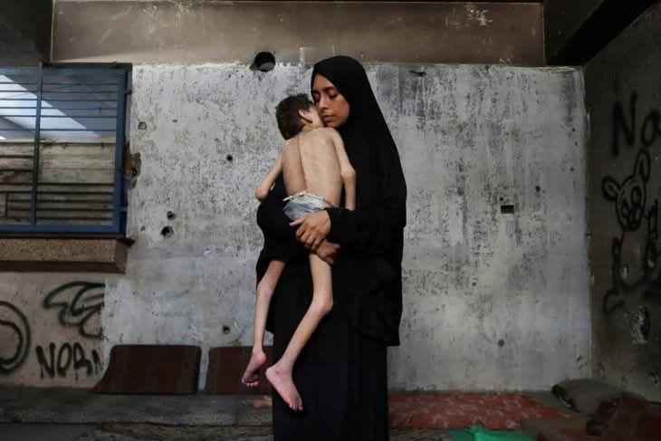 Krisis Pangan Makin Mencekam, Kasus Kematian Bayi Akibat Malnutrisi Kembali Terjadi di Gaza